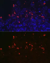 Anti-SFTPC antibody used in IHC (Paraffin sections) (IHC-P). GTX54694