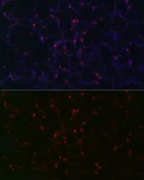 Anti-SFTPC antibody used in IHC (Paraffin sections) (IHC-P). GTX54694