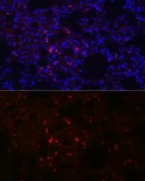 Anti-SFTPC antibody used in IHC (Paraffin sections) (IHC-P). GTX54694
