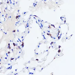 Anti-SFTPC antibody used in IHC (Paraffin sections) (IHC-P). GTX54694