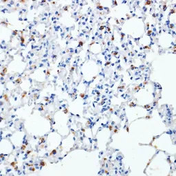 Anti-SFTPC antibody used in IHC (Paraffin sections) (IHC-P). GTX54694