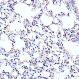 Anti-SFTPC antibody used in IHC (Paraffin sections) (IHC-P). GTX54694