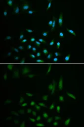 Anti-SUMO3 antibody used in Immunocytochemistry/ Immunofluorescence (ICC/IF). GTX54706