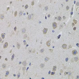 Anti-SUMO3 antibody used in IHC (Paraffin sections) (IHC-P). GTX54706