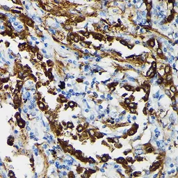 Anti-Surfactant Protein A antibody used in IHC (Paraffin sections) (IHC-P). GTX54714