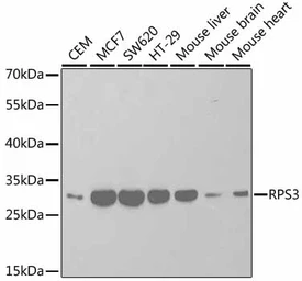 Anti-RPS3 antibody used in Western Blot (WB). GTX54720