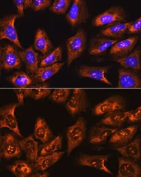 Anti-RPS3 antibody used in Immunocytochemistry/ Immunofluorescence (ICC/IF). GTX54720