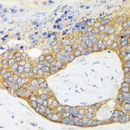 Anti-RPS3 antibody used in IHC (Paraffin sections) (IHC-P). GTX54720