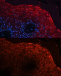 Anti-S100A8 antibody used in IHC (Paraffin sections) (IHC-P). GTX54721