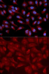 Anti-Epac1 antibody used in Immunocytochemistry/ Immunofluorescence (ICC/IF). GTX54723
