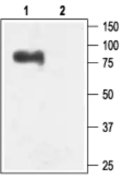Anti-KCNN3 antibody used in Western Blot (WB). GTX54779