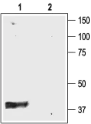 Anti-Kir4.1 antibody used in Western Blot (WB). GTX54781