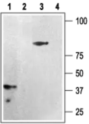 Anti-P2Y12 antibody used in Western Blot (WB). GTX54796