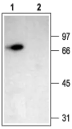 Anti-ACCN1 antibody used in Western Blot (WB). GTX54802
