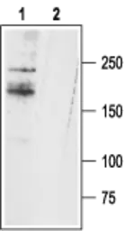 Anti-SCN11A antibody used in Western Blot (WB). GTX54806