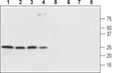 Anti-SCN4B antibody used in Western Blot (WB). GTX54810