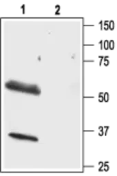 Anti-Orexin Receptor 1 antibody used in Western Blot (WB). GTX54847