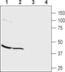 Anti-PICK1 antibody used in Western Blot (WB). GTX54853