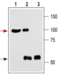 Anti-Maxi Potassium channel alpha antibody used in Immunoprecipitation (IP). GTX54874