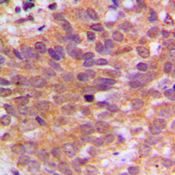 Anti-c-Abl antibody used in IHC (Paraffin sections) (IHC-P). GTX54905