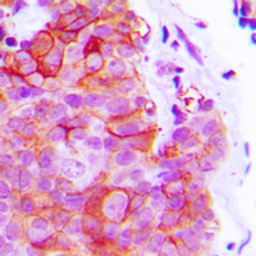 Anti-alpha 2c Adrenergic Receptor antibody used in IHC (Paraffin sections) (IHC-P). GTX54924