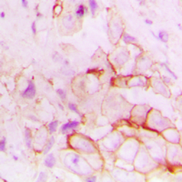 Anti-ACE antibody used in IHC (Paraffin sections) (IHC-P). GTX54938