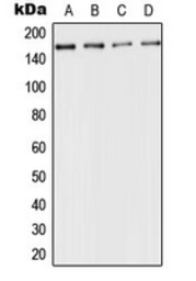 Anti-ACE antibody used in Western Blot (WB). GTX54938