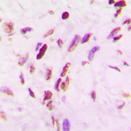 Anti-p53 (Acetyl Lys319) antibody used in IHC (Paraffin sections) (IHC-P). GTX54949