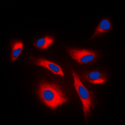 Anti-MEK1/2 (phospho Ser222/Ser226) antibody used in Immunocytochemistry/ Immunofluorescence (ICC/IF). GTX54969