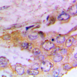 Anti-CaMK1 (phospho Thr177) antibody used in IHC (Paraffin sections) (IHC-P). GTX54970