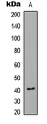 Anti-CaMK1 (phospho Thr177) antibody used in Western Blot (WB). GTX54970