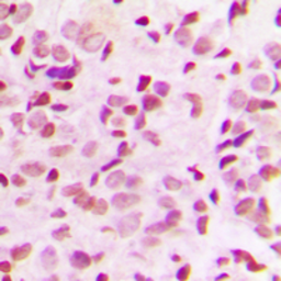 Anti-NFkB p65 (phospho Thr435) antibody used in IHC (Paraffin sections) (IHC-P). GTX54983