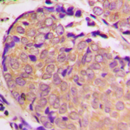 Anti-alpha Synuclein (phospho Ser129) antibody used in IHC (Paraffin sections) (IHC-P). GTX54991