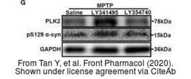 Anti-alpha Synuclein (phospho Ser129) antibody used in Western Blot (WB). GTX54991