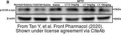 Anti-alpha Synuclein (phospho Ser129) antibody used in Western Blot (WB). GTX54991