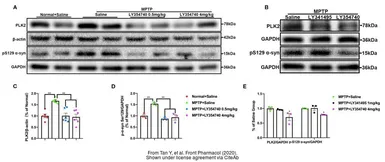 Anti-alpha Synuclein (phospho Ser129) antibody used in Western Blot (WB). GTX54991