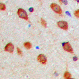 Anti-Aurora A (phospho Thr288) antibody used in IHC (Paraffin sections) (IHC-P). GTX55002