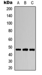 Anti-Aurora A (phospho Thr288) antibody used in Western Blot (WB). GTX55002