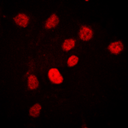 Anti-C/EBP beta (phospho Thr235) antibody used in Immunocytochemistry/ Immunofluorescence (ICC/IF). GTX55008