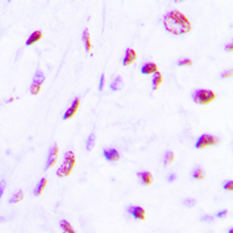 Anti-C/EBP beta (phospho Thr235) antibody used in IHC (Paraffin sections) (IHC-P). GTX55008