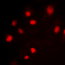 Anti-Splicing factor 1 (phospho Ser82) antibody used in Immunocytochemistry/ Immunofluorescence (ICC/IF). GTX55031