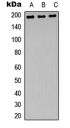 Anti-NMDAR2B (phospho Tyr1472) antibody used in Western Blot (WB). GTX55067
