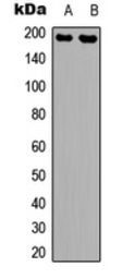 Anti-NMDAR2B (phospho Tyr1336) antibody used in Western Blot (WB). GTX55068