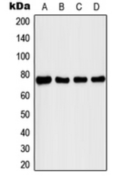 Anti-IRAK1 (phospho Thr209) antibody used in Western Blot (WB). GTX55098