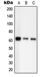 Anti-PAK2 (phospho Ser20) antibody used in Western Blot (WB). GTX55101