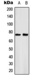 Anti-NFkB p65 (phospho Ser529) antibody used in Western Blot (WB). GTX55127