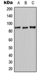 Anti-CLCN7 antibody used in Western Blot (WB). GTX55139