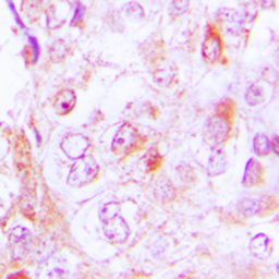 Anti-Collagen VI alpha 2 antibody used in IHC (Paraffin sections) (IHC-P). GTX55141
