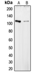 Anti-Collagen VI alpha 2 antibody used in Western Blot (WB). GTX55141