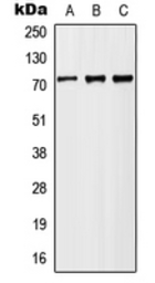 Anti-MX2 antibody used in Western Blot (WB). GTX55158
